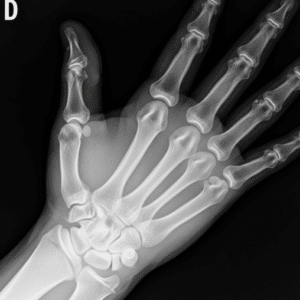 Descubre la Revolución de Rayos X Móviles