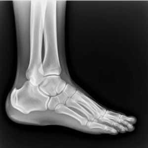 Rayos X: Descubre lo Invisible