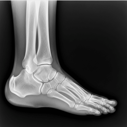 Rayos X: Descubre lo Invisible