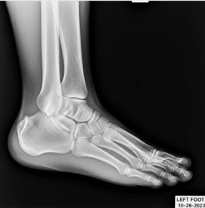 Revela Lo Invisible Fácilmente