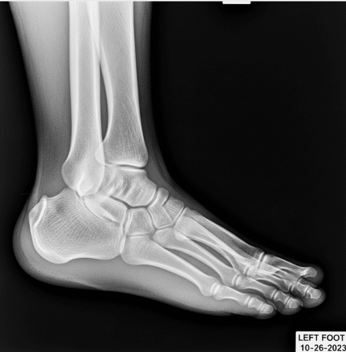 Revela Lo Invisible Fácilmente