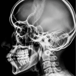 Rayos X: Diagnósticos Precisos y Eficientes