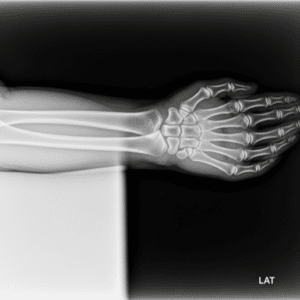 Rayos X: Revolución Médica e Industrial