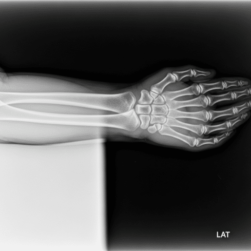 Rayos X: Revolución Médica e Industrial