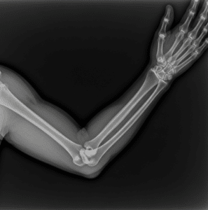 Rayos X: Diagnósticos y Tratamientos Precisos