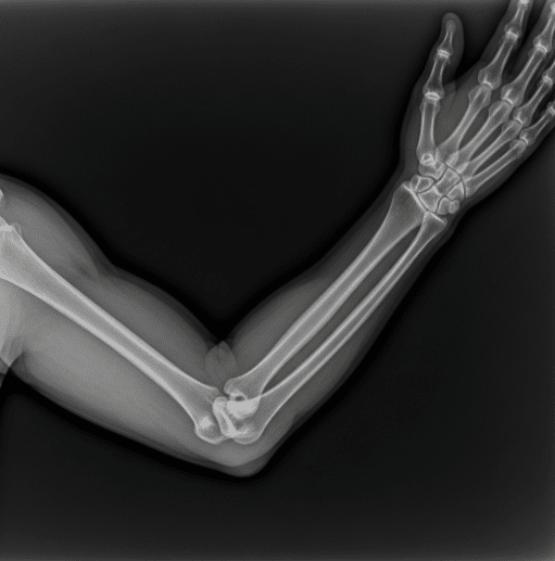 Rayos X: Diagnósticos y Tratamientos Precisos