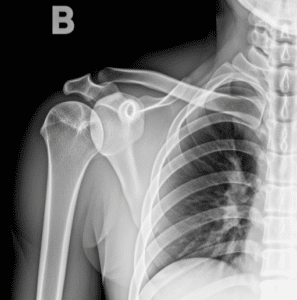 Rayos X: Revolución en Diagnósticos