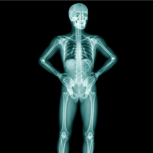 Rayos X en Medicina y Simuladores en Celulares
